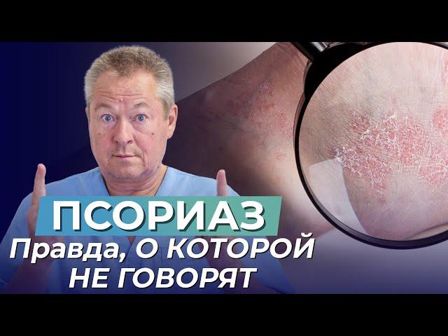 ПСОРИАЗ? ЛЕЧИТЕ КИШЕЧНИК, А НЕ КОЖУ! Правда, О КОТОРОЙ НЕ ГОВОРЯТ врачи!