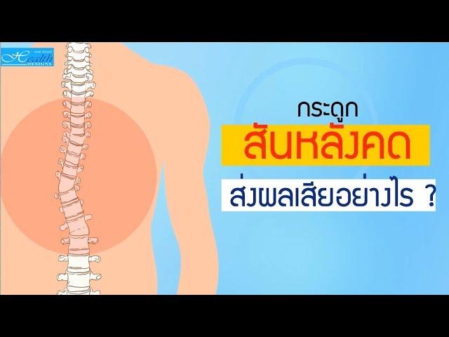 กระดูกสันหลังคด ส่งผลเสียอะไรกับเราบ้าง ? - สุขภาพดีออกแบบได้ by thehealthdesigns