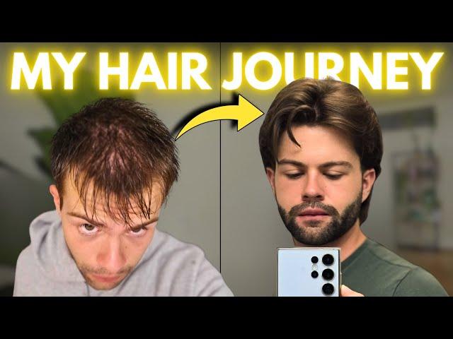 How I Stopped Hair Loss at 20: Month-by-Month Results | AL GARRIDO