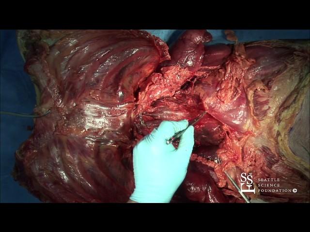 Thoracic Cavity Overview