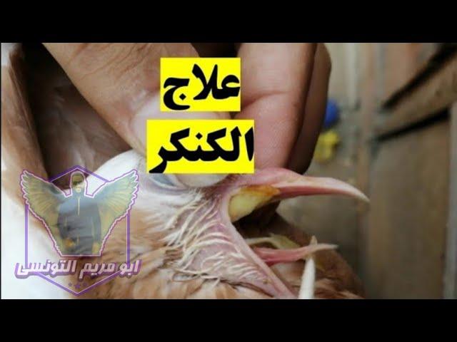 علاج مرض الكنكر عند الحمام بأسهل طرق العلاج