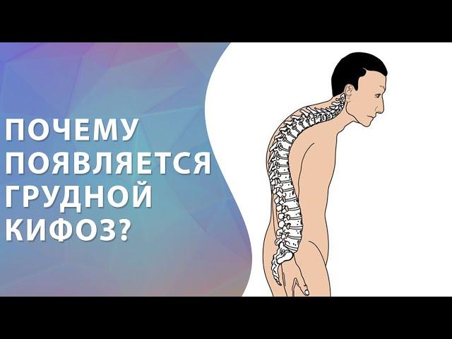 Грудной кифоз. Кифоз грудного отдела. Причины грудного кифоза