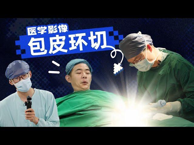 Millennial’s First Circumcision Surgery With Boss and Colleagues Watching?!