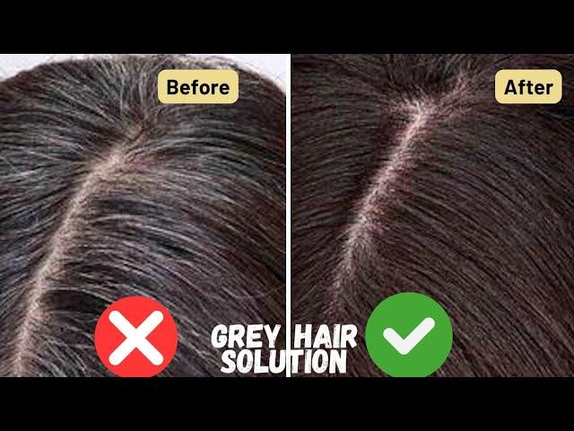 Grey Hair Homemade Solution| Remedies for Grey Hair| White Hair to Black Naturally