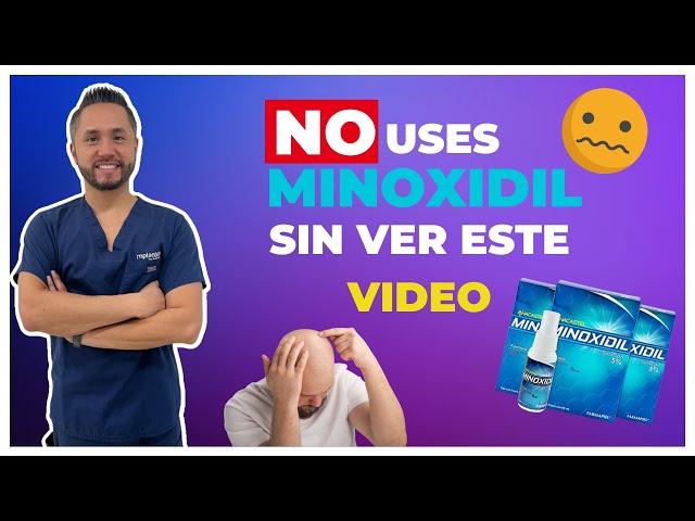  DOCTOR te EXPLICA como APLICARTE MINOXIDIL