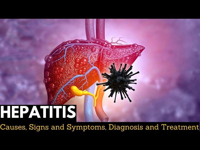 Hepatitis, Causes, Signs and Symptoms, Diagnosis and Treatment.