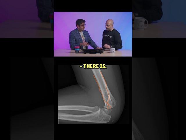 Throwback to our ODM episode where Kash and Anish go through how to interpret paediatric elbow x-ray