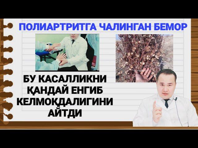 ПОЛИАРТРИТ ХАҚИДА / ДОКТОР ИСЧАНОВ ТАВСИЯСИ БИЛАН КАСАЛЛИКНИ ЕНГИБ КЕЛАЁТГАН БЕМОР БИЛАН СУҲБАТ