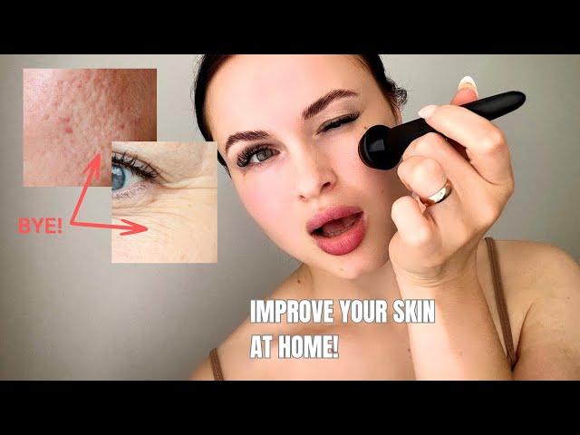 How to Do Microneedling at Home: Banisher 3.0 Review & Tutorial