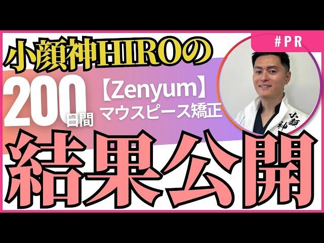 マウスピース矯正【Zenyum】200日終了！結果報告と感想をお伝えします！！#PR #zenyum