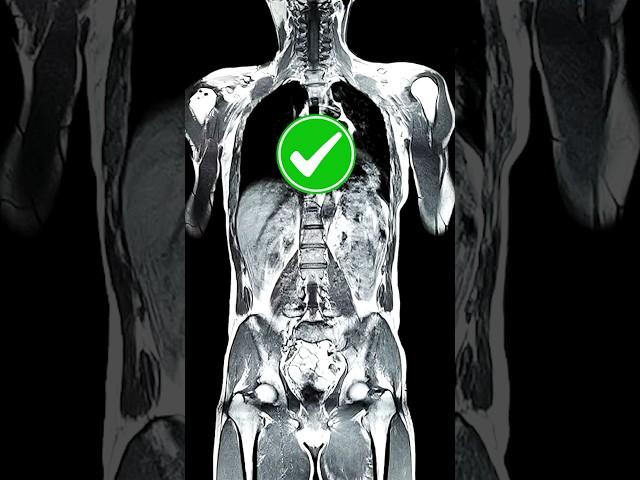 X-Ray vs CT-scan vs MRI