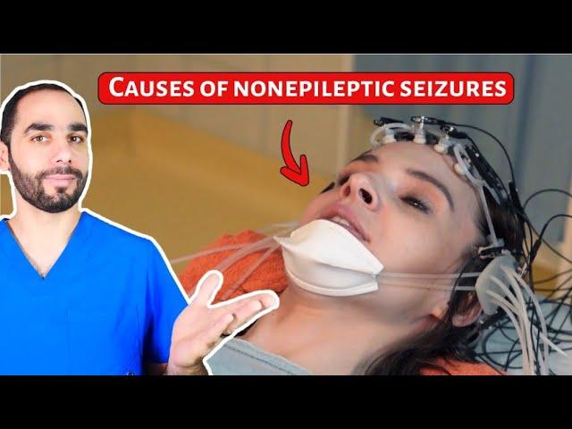 Causes of Nonepileptic Seizures (PNES). Hint, NOT Stress!