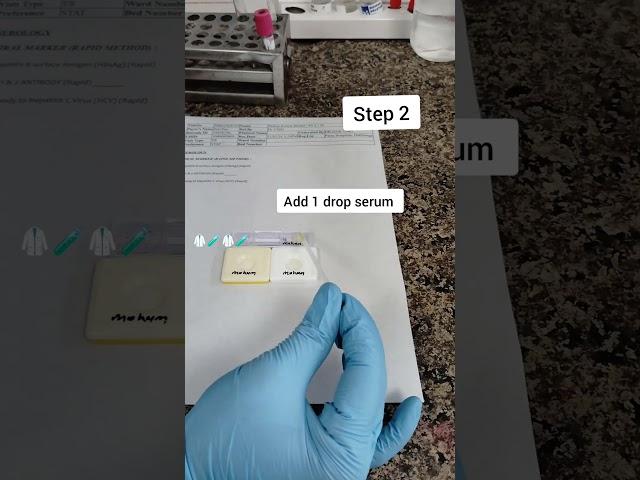 Viral Marker | HIV | HBSAG | HCV #lab #serology #immunology