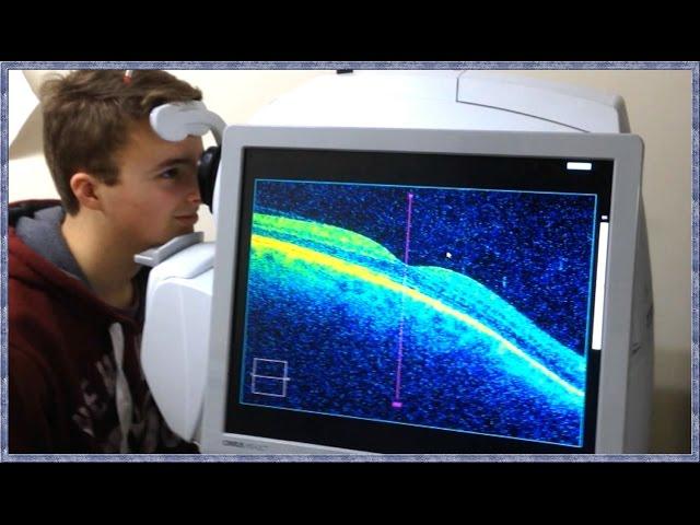 What is OCT Scanning? (Optical Coherence Tomography)