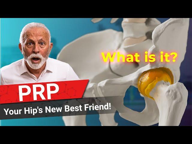 The best treatment for hip arthritis: Platelet Rich Plasma Injections