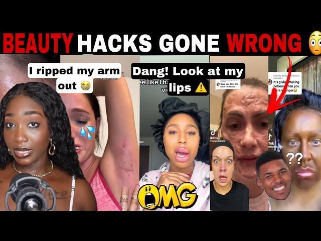 MERCY! BEAUTY HACKS GONE WRONG! COSMETIC TRAUMA DIY BEAUTY FAILS | TIK TOK COMP