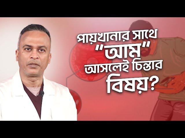 পায়খানার সাথে আম যাওয়া চিন্তার বিষয় | আমাশয় | কারণ, লক্ষণ, চিকিৎসা এবং প্রতিরোধ | DrFerdousUSA |