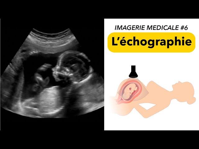 IMAGERIE MÉDICALE #6 : L’échographie