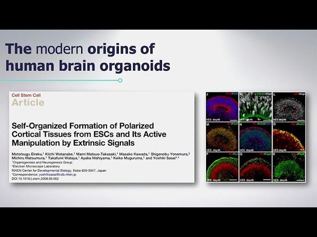 Rescuing Phenotypes in PTHS-Derived Brain Organoids with Alysson Muotri
