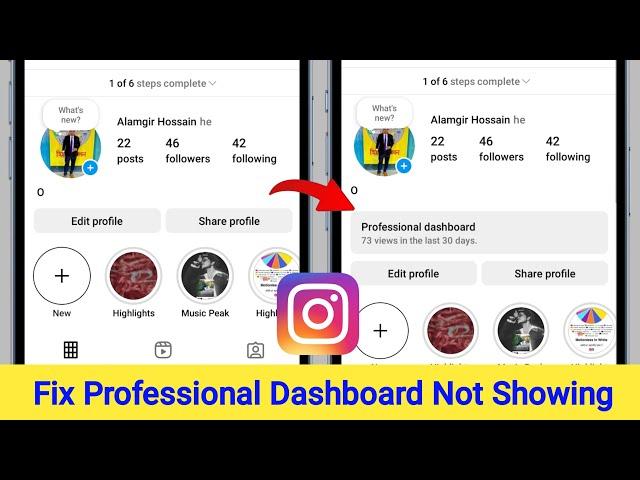 Fix Instagram Professional Dashboard Not Showing Problem 2025 || Professional Dashboard Missing