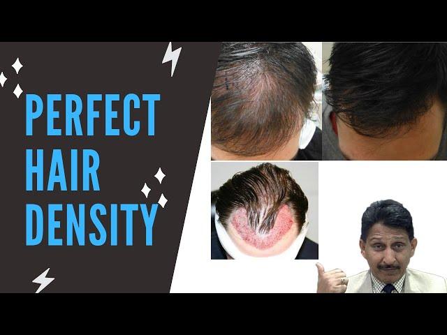 Do you want perfect hair density? | Best Hair Transplant  Doctor in Kolkata Dr. Manoj Khanna