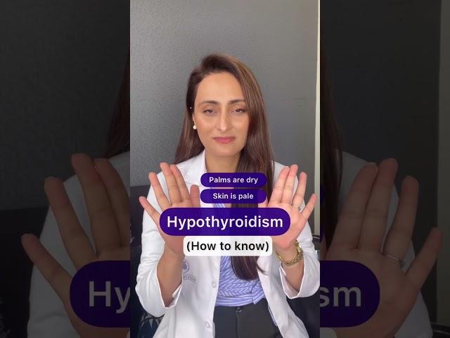 Hypothyroidism l Signs & symptoms l Dr. Aanchal Panth