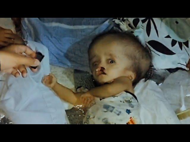 Baby na may Hydrocephalus at Cleft | BP Charity Ep.2 P1 | No Ads, Pure Charity.