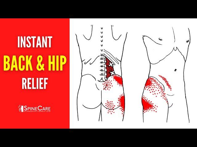 How to Fix Hip and Back Pain on One Side