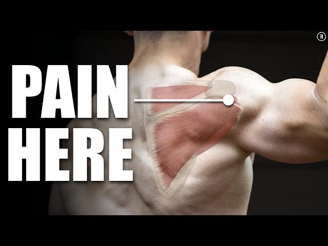 Rotator Cuff Tear Rehab & Exercises (Shoulder Pain, Tendinitis, Impingement)