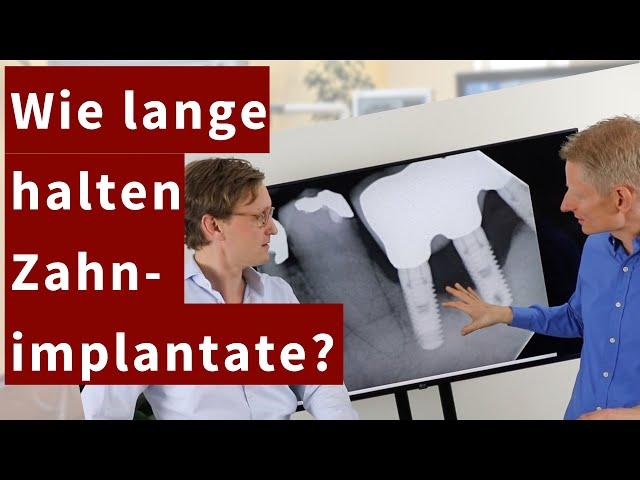 Wie lange halten Zahnimplantate? - aus unserer Zahnarztpraxis in Potsdam