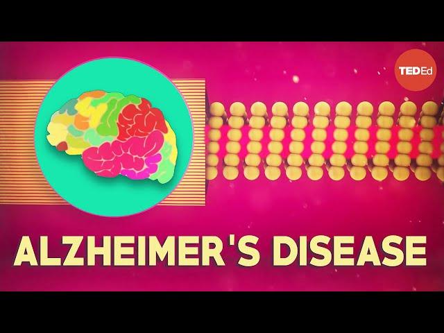 What is Alzheimer's disease? - Ivan Seah Yu Jun