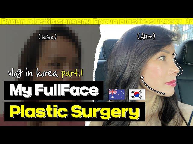 Complete Korean Plastic surgery Makeover│Middle aged woman finds her newself (Part1)