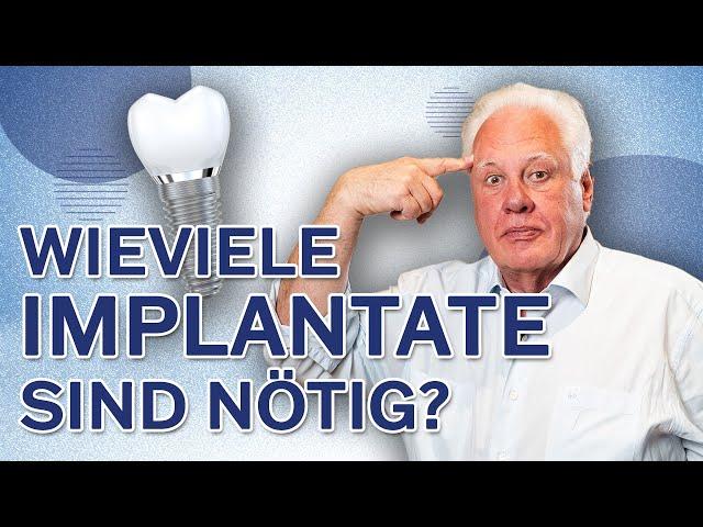 Mit wie vielen Implantaten sollte man fehlende Zähne ersetzen?