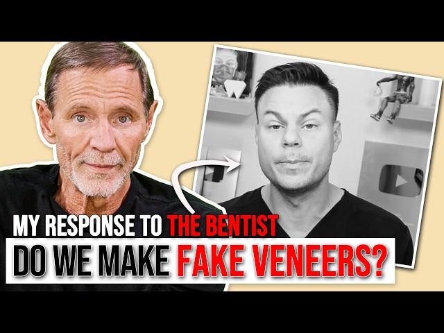 BEST Fake Snap On Veneers? A Response to @Thebentist