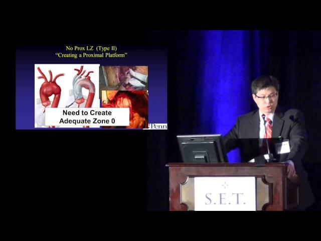 Hybrid Approaches to the Aortic Arch