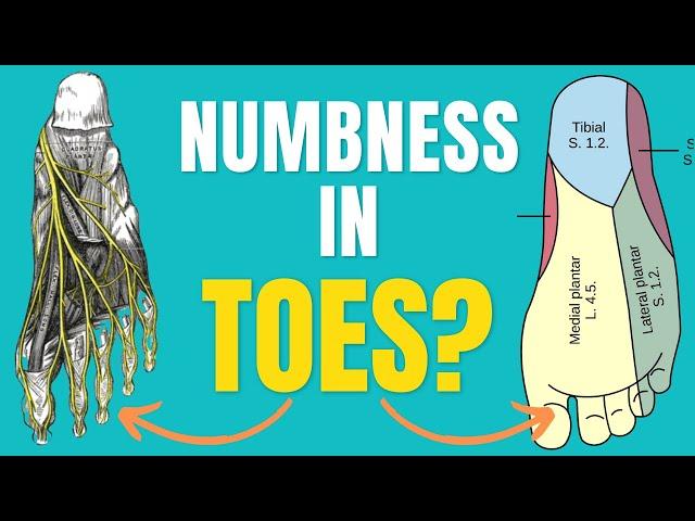 5 Causes Of Numbness In Toes & How To Treat Numbness In Toes