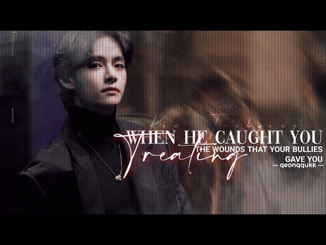 When He Caught you Treating the Wounds that your Bullies gave You || Taehyung FF || Oneshot