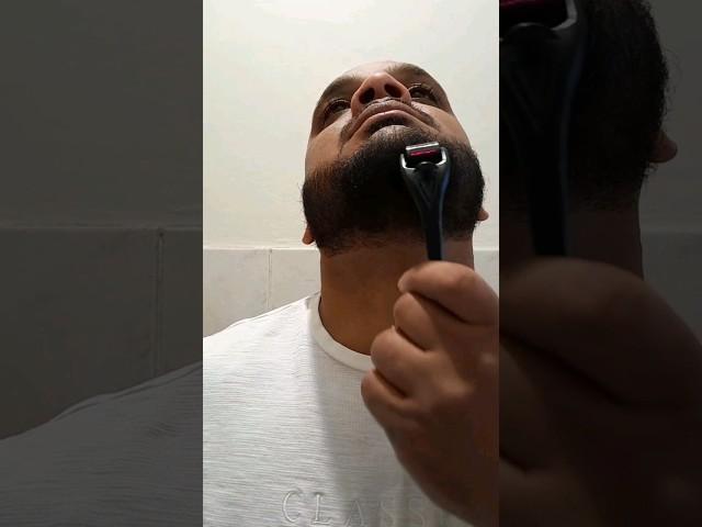 My once a week derma roller routine for beard growth. #dermaroller #beardgrowth #journey #ytshorts