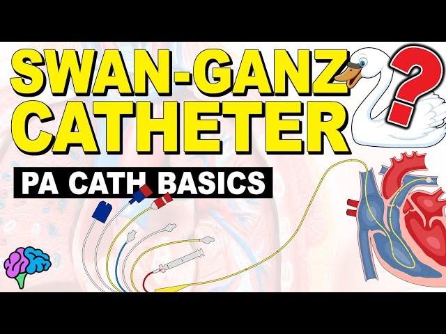 The BASICS of the Pulmonary Artery Catheter