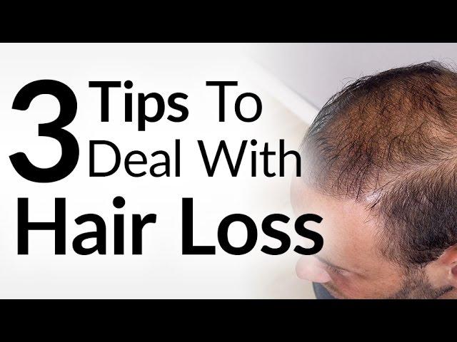 3 Hair Loss Treatment Options | Attract Women While BALDING | Increase Confidence With Thinning Hair