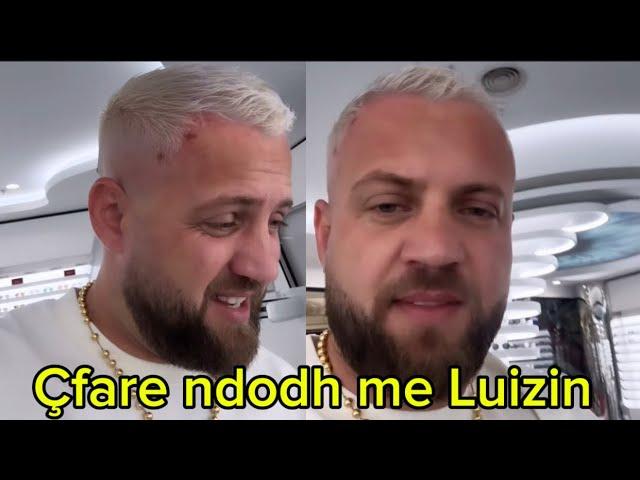 Zbardhet e verteta cfare ndodhi me koken e Luiz Ejllit ku u lendua ai (Detaje)