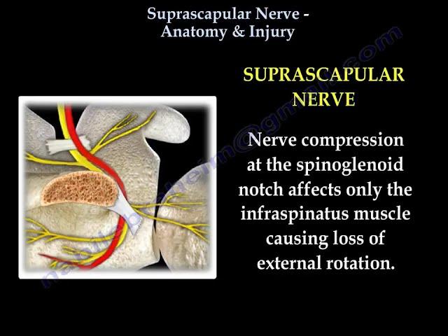 Suprascapular Nerve Anatomy & Injury   Everything You Need To Know   Dr  Nabil Ebraheim