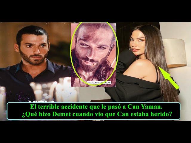 El terrible accidente que le pasó a Can Yaman. ¿Qué hizo Demet cuando vio que Can estaba herido?