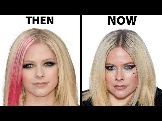 Did Avril Lavigne Have Plastic Surgery? | Plastic Surgery Analysis