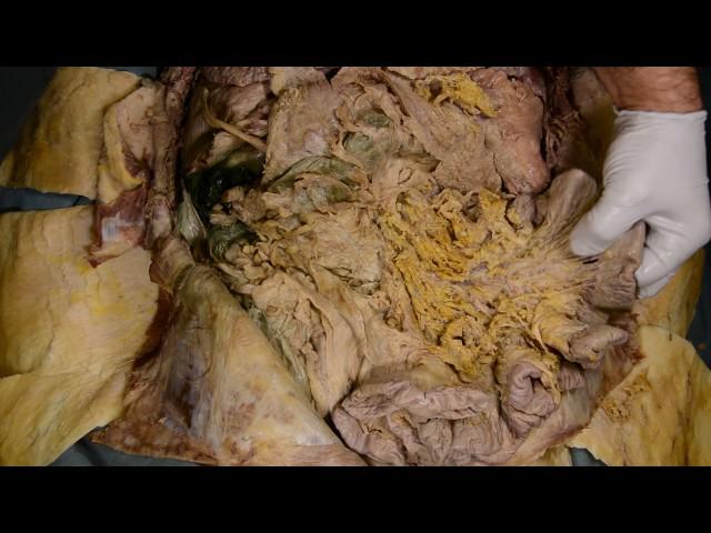 Gross Anatomy of the Midgut and Hindgut abdominal region