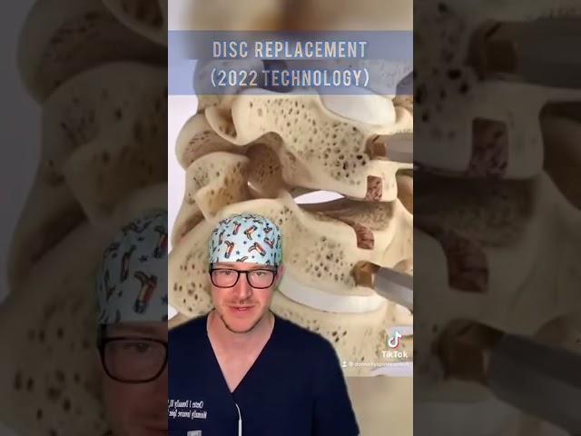 Disc Replacement Technology in 2022 (Texan Spine Surgeon Explains) 