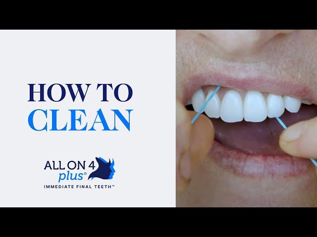 How to Clean Your All On 4 Plus® Dental Implants