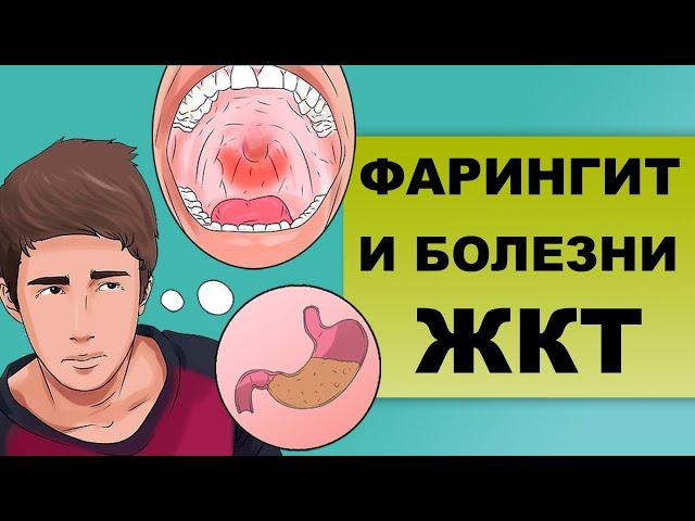 ФАРИНГИТ И ЖКТ. Как связан желудок и ЛОР-заболевания