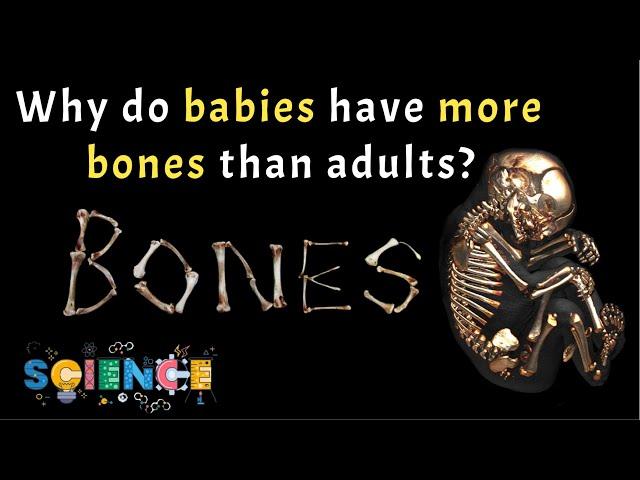 Why do babies have more bones than adults? - Science facts that will blow your mind | Do you know?