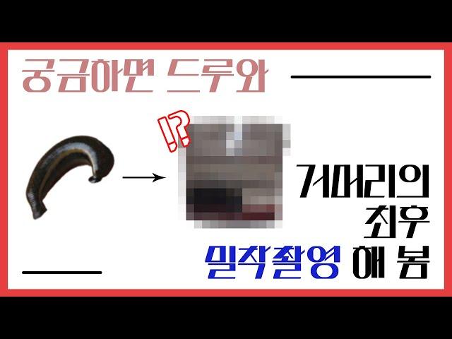 Leech therapy   의료용 거머리의 최후 거머리시술후 처리법